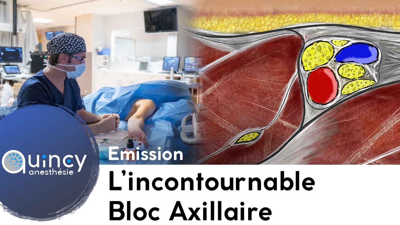 Maîtriser le Bloc Axillaire : anatomie, techniques et astuces pour une réussite maximale