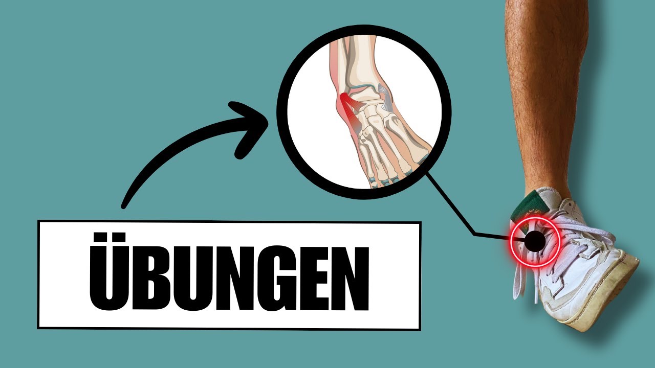 Die besten Bänderriss Übungen für das Sprunggelenk (evidenzbasiert)