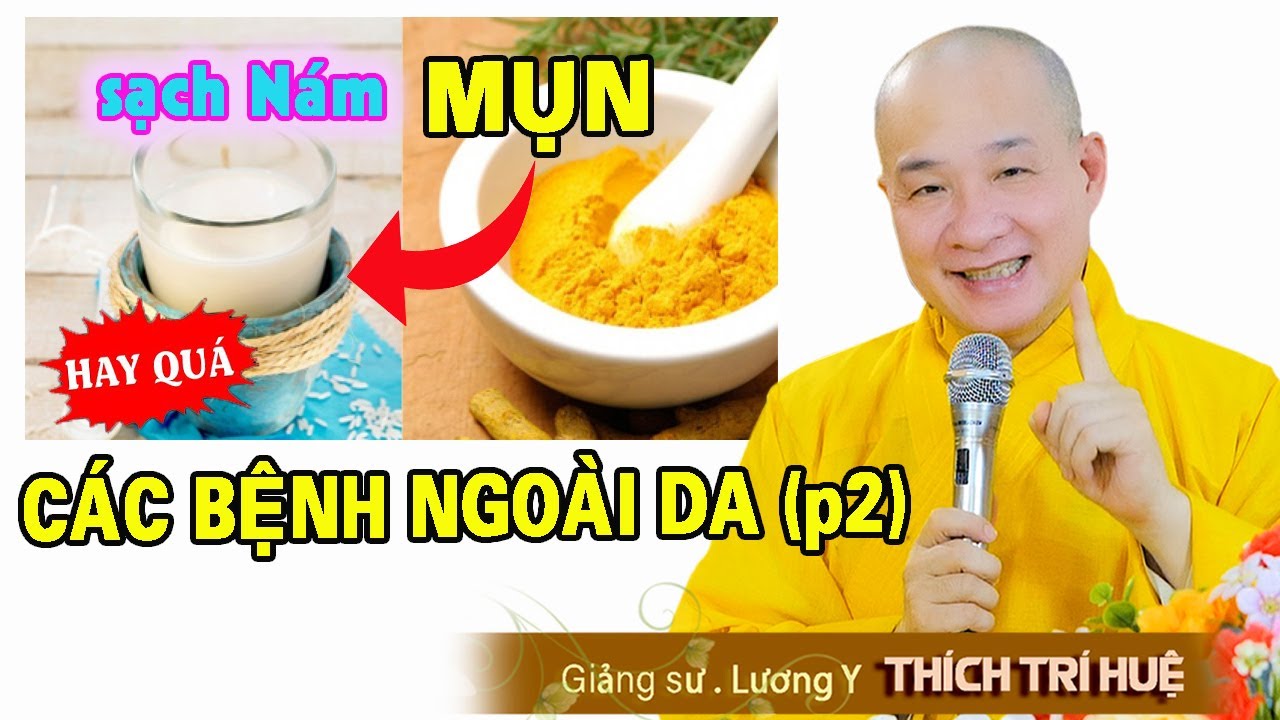 DA SẠCH NÁM - Mụn, Hết liền mẩn ngứa, các bệnh ngoài da (p2) - Thầy Thích Trí Huệ