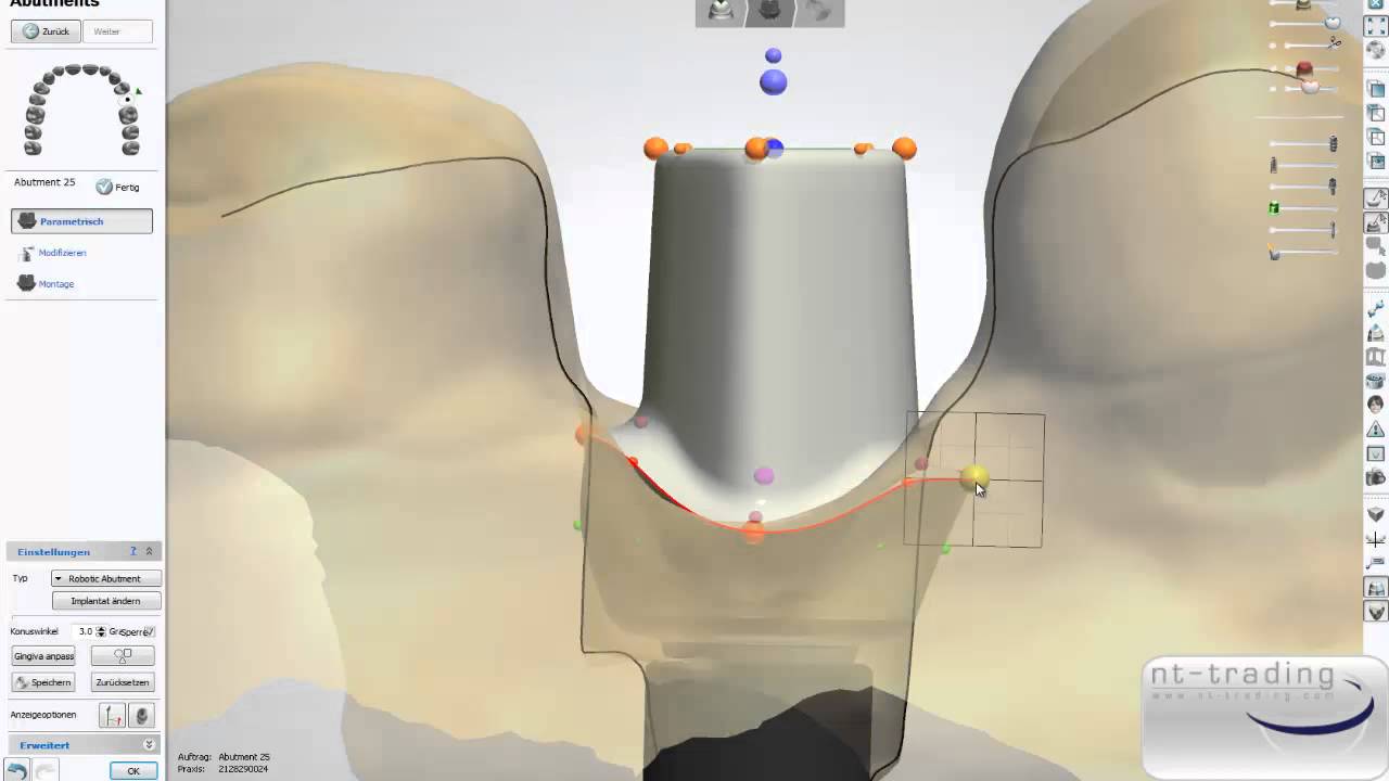 NT Dental - Hybrid Abutment Design in 3shape®