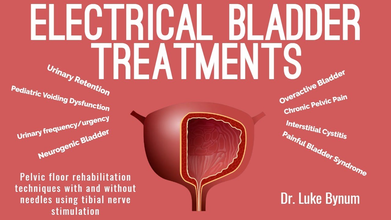 Overactive Bladder FIX - Percutaneous Tibial Nerve Stimulation (PTNS)