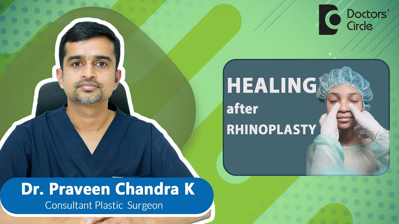 Nose Job | Rhinoplasty recovery time  