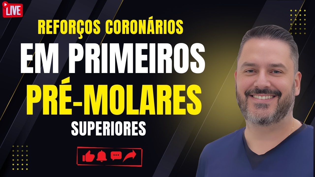 Reforços coronários em primeiros pré-molares superiores