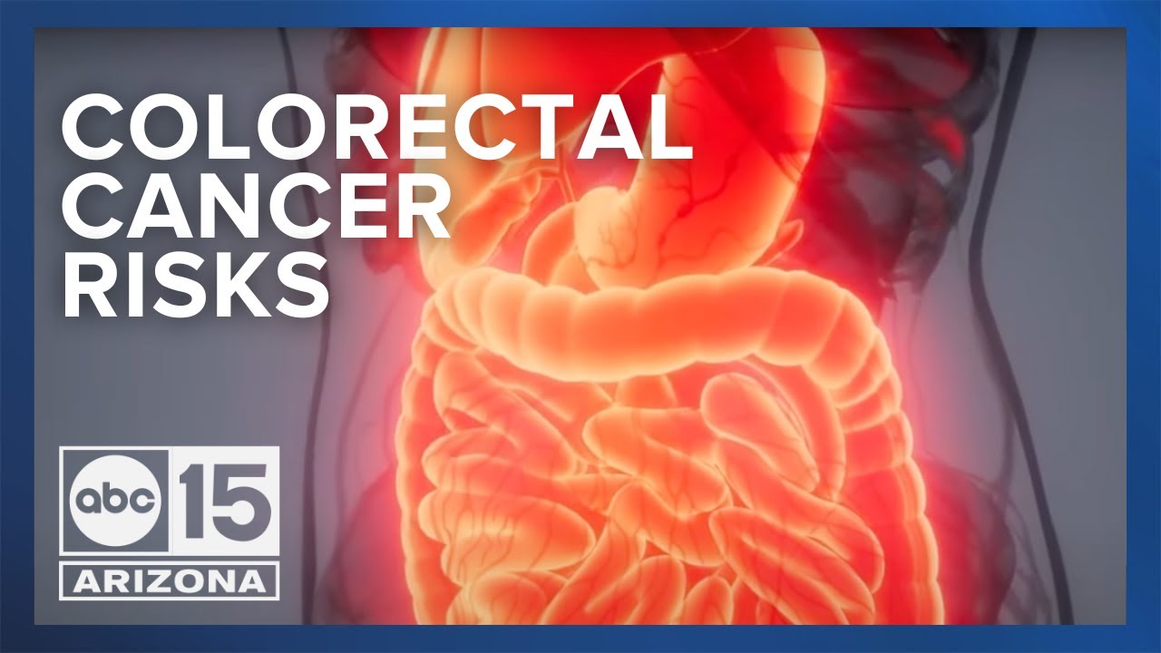 Dietary risk factors for colorectal cancer