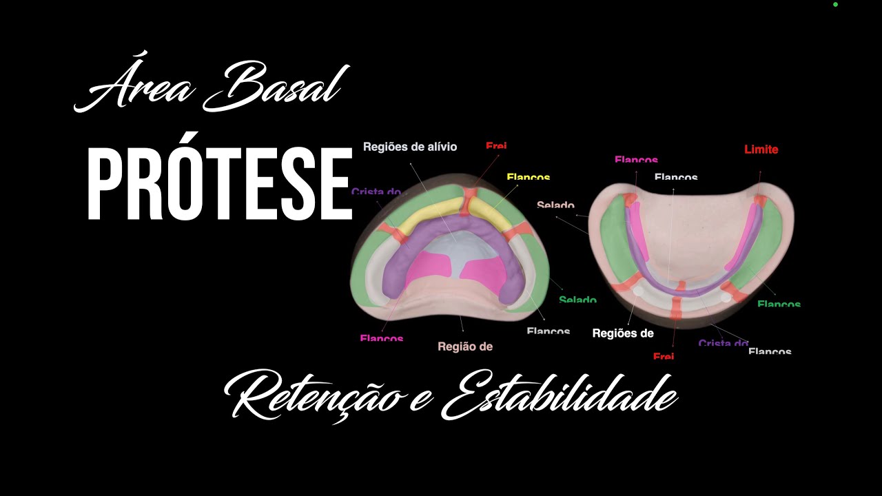 Prótese Total #3 Área Basal, Retenção e Estabilidade