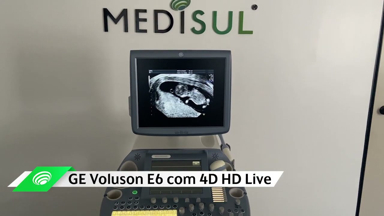 Medisul - GE Voluson E6 com 4D HD Live