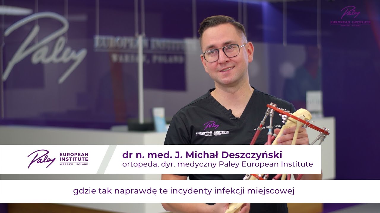 Paley European Institute - Wydłużanie kończyn z użyciem aparat&oacute;w zewnętrznych