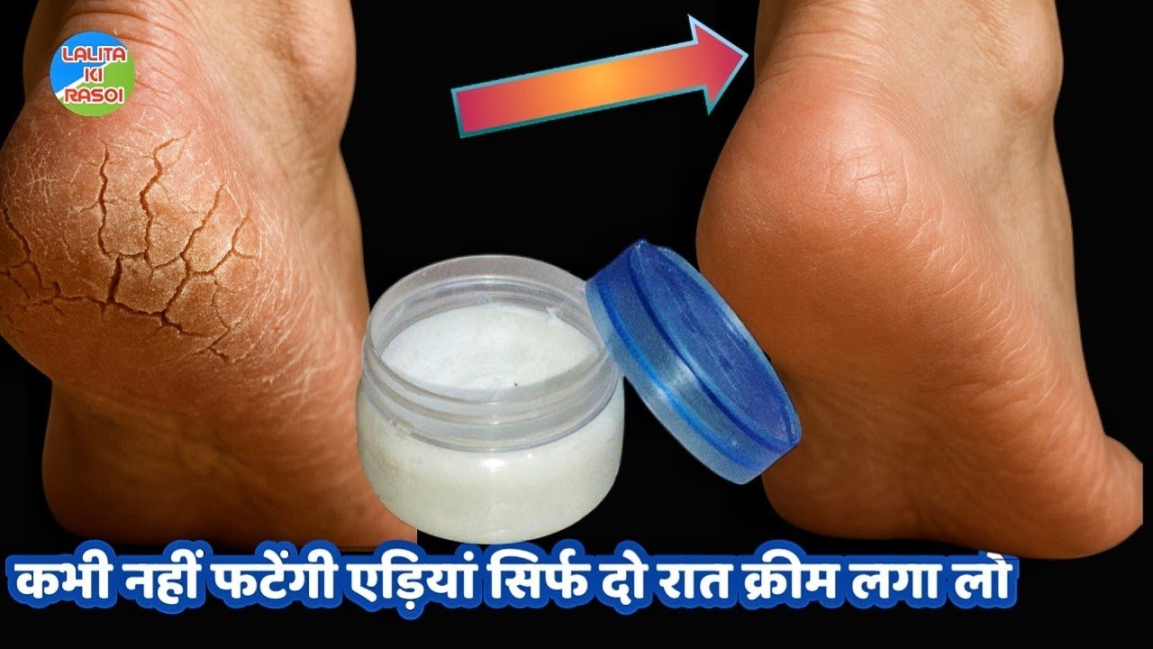 घर में बनाएं सर्दियों में फटी एड़ियों पर लगाने के लिए क्रीम सिर्फ दो दिन में ही चिकनी होंगे।