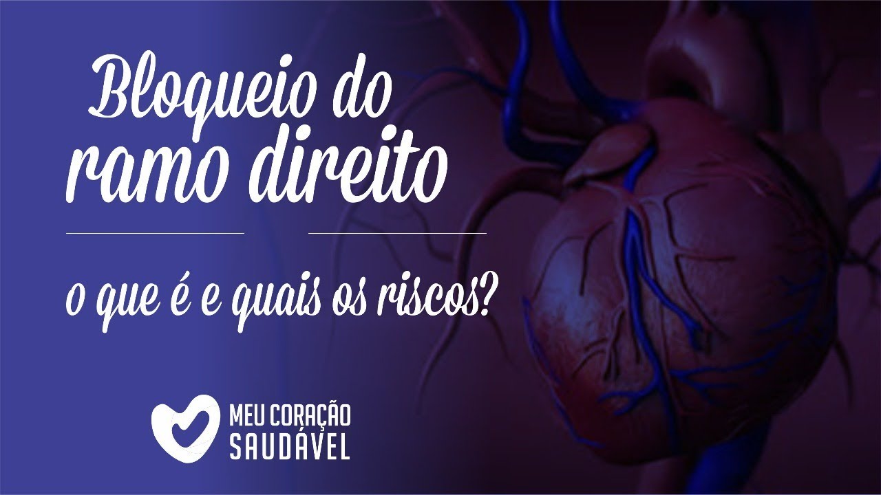 Bloqueio de Ramo direito: o que é e quais os riscos?