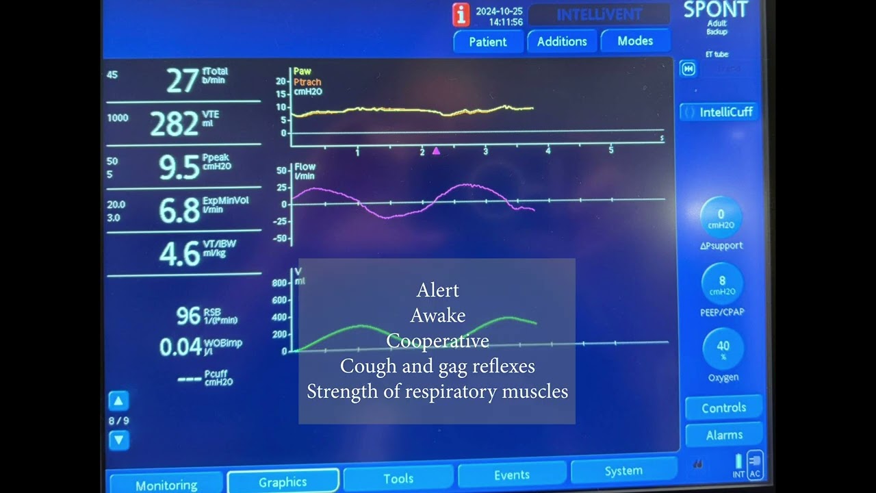 Quick Assessment of A Spontaneous Breathing Trial (SBT) with Negative Inspiratory Force (NIF)