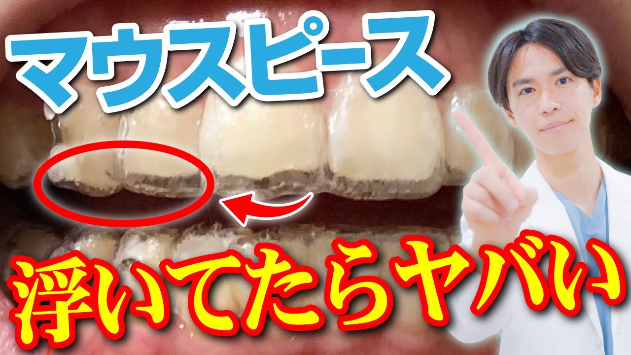 【要注意】マウスピースが浮いてハマらない時の対処法を教えます