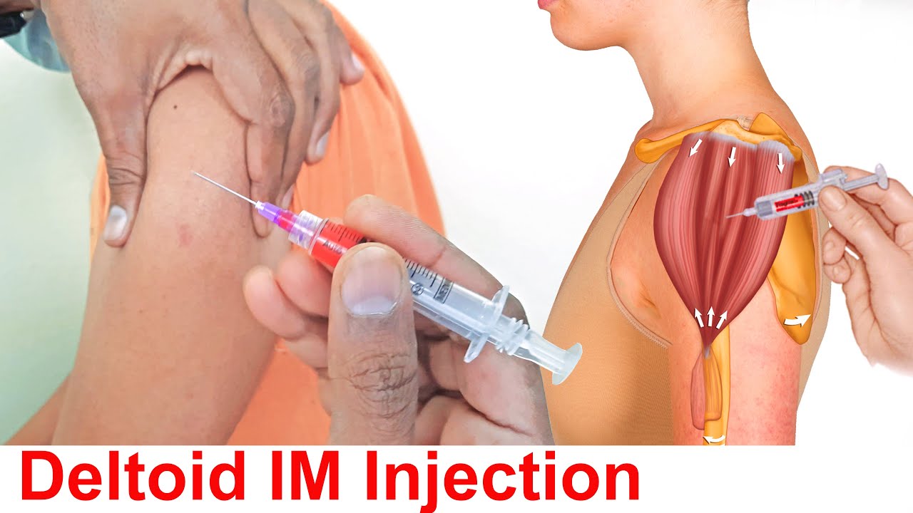 How to give an intramuscular (IM) Injection in deltoid muscle in shoulder easily at home