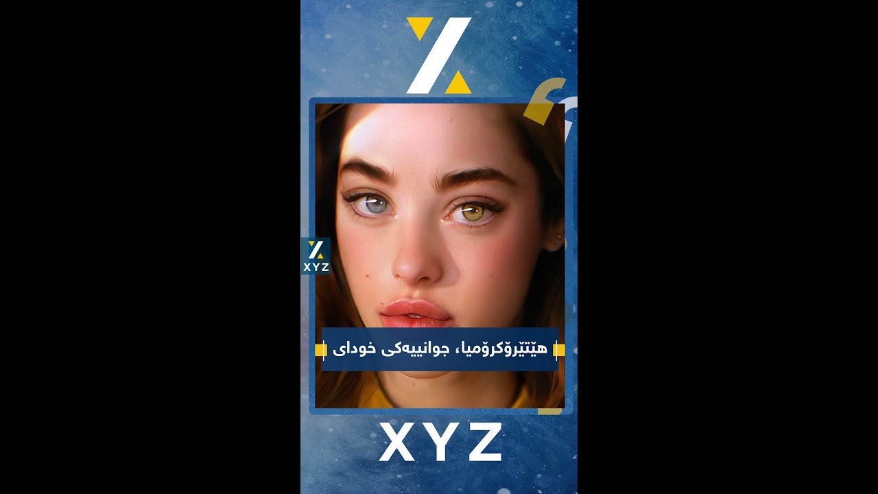 هێتێرۆکرۆمیا، جوانییەکی خودای