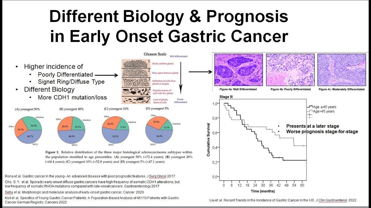 7 Increasing Gastroesophageal Cancer in the Young?