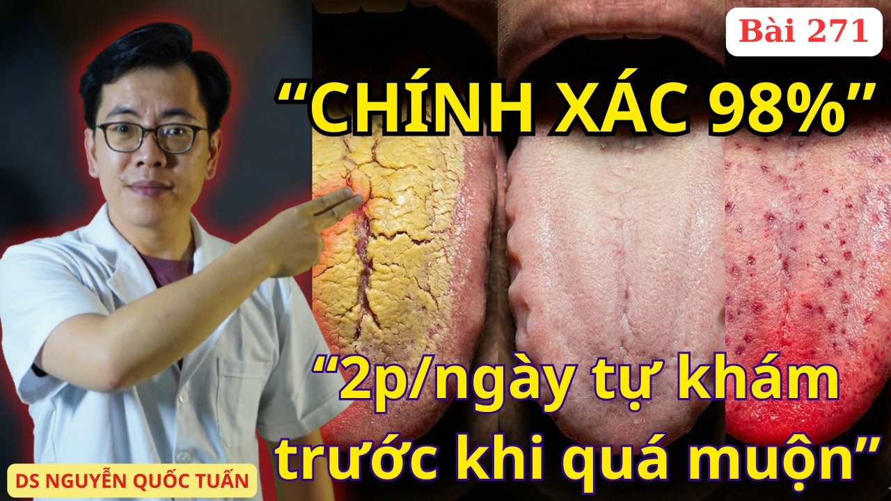 NHÌN LƯỠI ĐOÁN BỆNH (CHÍNH XÁC 98%) - Giải mã trí tuệ phương pháp THIỆT CHẨN 1500 năm trước