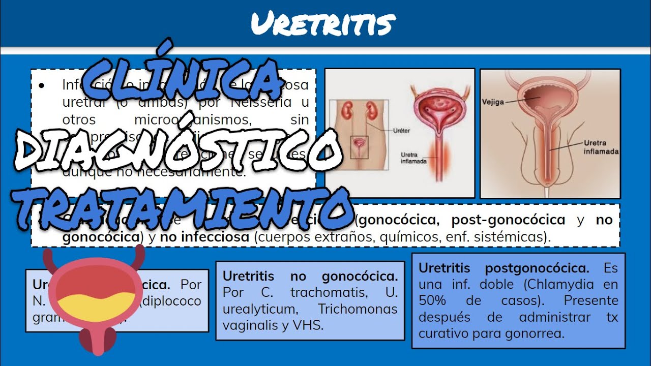 ⚕️🩺 URETRITIS (Gonocócica y No Gonocócica): Síntomas, Diagnóstico y Tratamiento