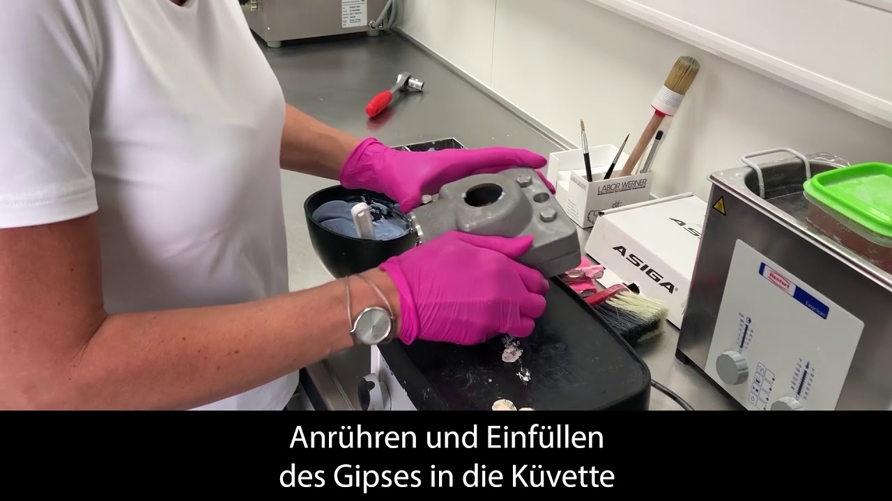 Herstellung Total Prothese mit Injektionsverfahren (Futura)