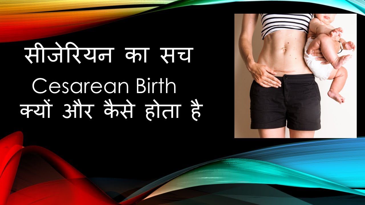 सीजेरियन का सच  /  CESAREAN BIRTH  क्यों और कैसे होता है / C - Section - Complete Details