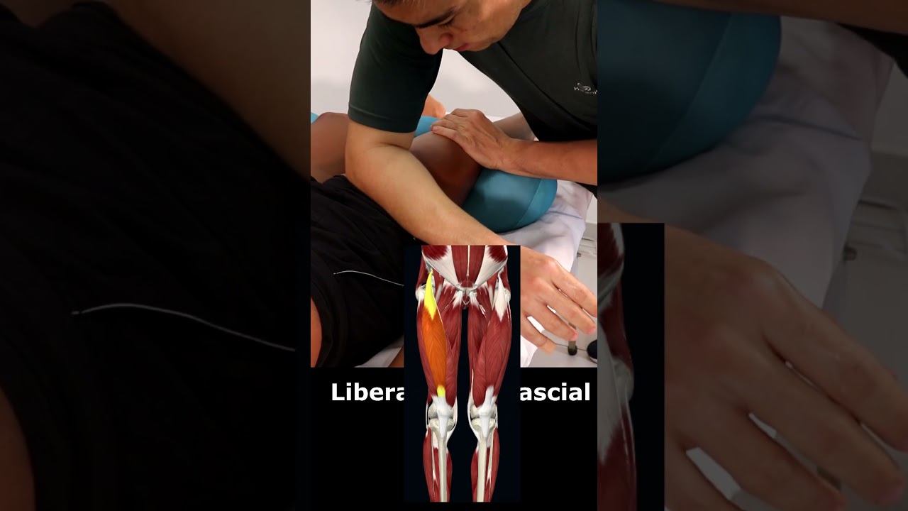 Liberação Miofascial na Coxa #massoterapeuta #thiagonishida