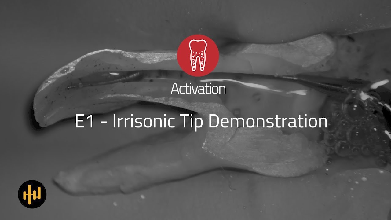 Helse Ultrasonic Endo - Activation - E1 Irrisonic Tip Demonstration