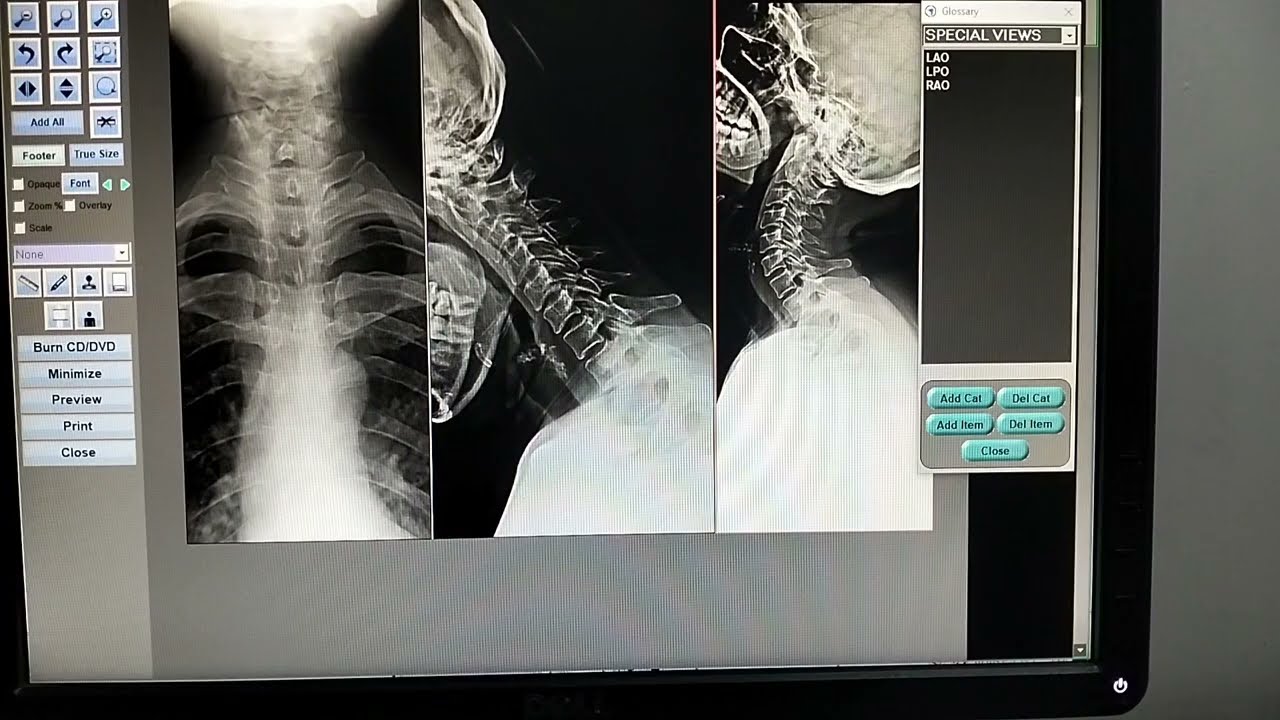 P-11 How to Add Categories and Markers in Fujifilm #medicos1k86 #radiology #xray #video #radiography