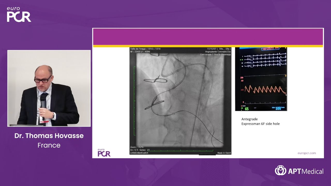 Optimal Solutions from APT Medical in CTO-PCI: Hybrid Approach - Dr. Thomas Hovasse (France)