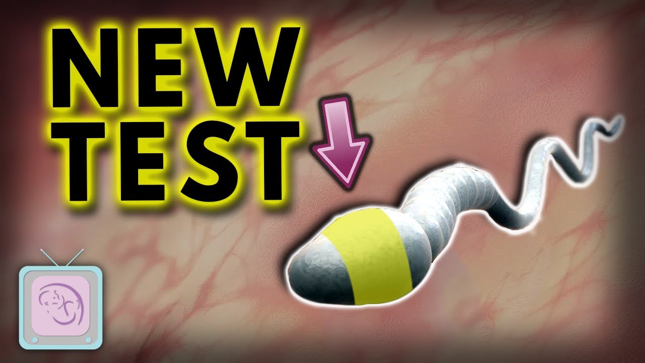 New Advanced Sperm Test for Male Infertility goes beyond the Semen Analysis