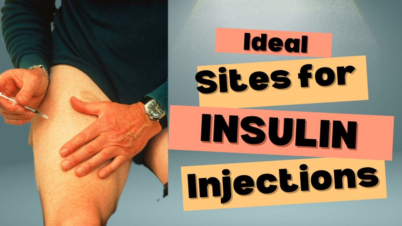 Insulin Injection Sites and Rotation