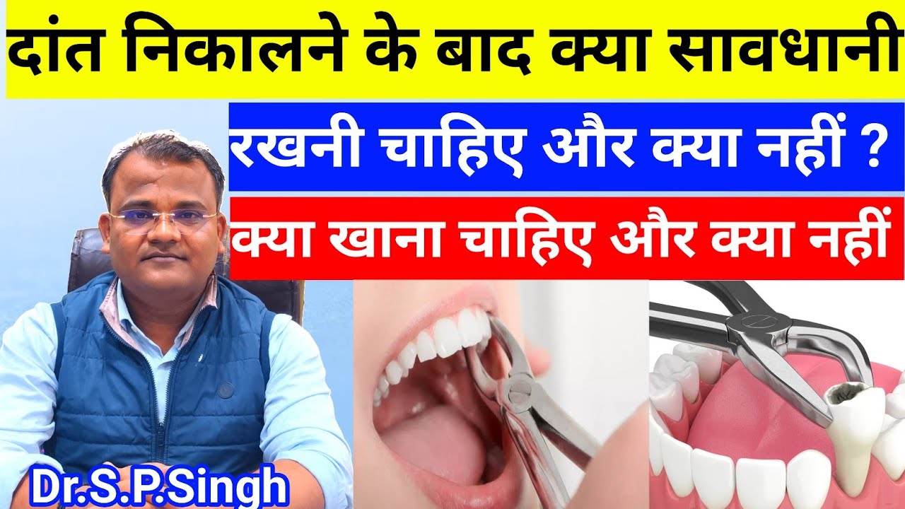दांत निकालने के बाद क्या सावधानी रखनी चाहिए और क्या नहीं || क्या खाना चाहिए और क्या नहीं || 