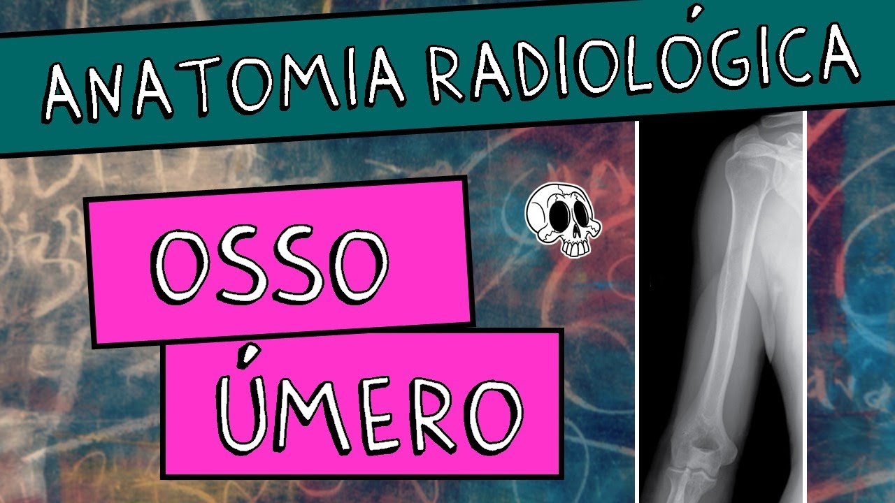 Anatomia radiológica (RX) dos MEMBROS SUPERIORES (Parte 4/5) - OSSO ÚMERO