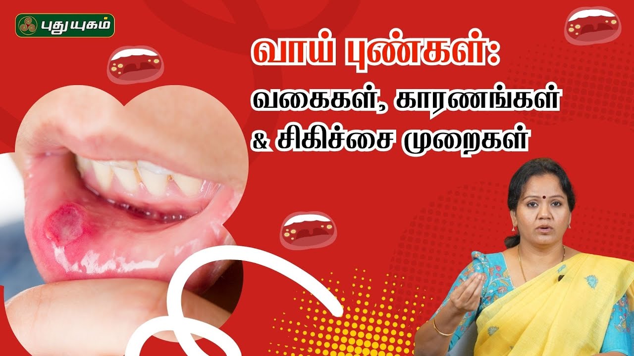 வாய் புண்கள்: வகைகள், காரணங்கள் & சிகிச்சை முறைகள் | Dr.Jayaroopa | Tamil Health tips #Mouthulcers
