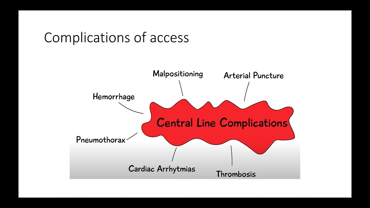 Venous Access and Basic Abbott Programmer Navigation - Port Harcourt Pacing