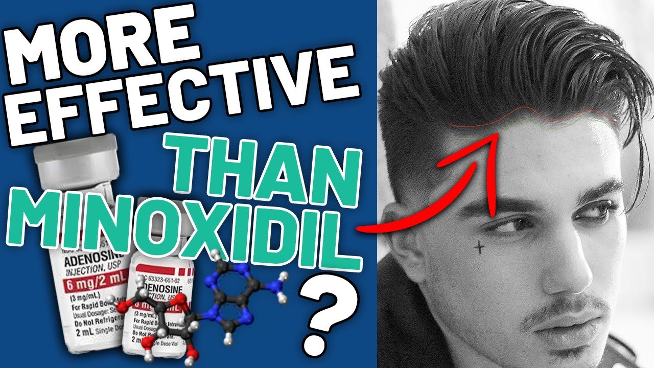 Adenosine for hair loss - More effective than minoxidil?
