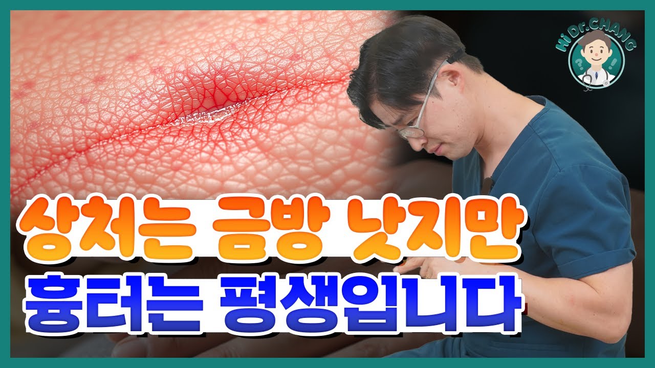 흉터 걱정된다면 꼭 보세요! 상처 치료의 진짜 핵심은 &lsquo;이것&rsquo;입니다