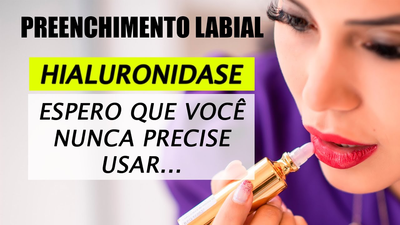 Uso da Hialuronidase no Preenchimento Labial