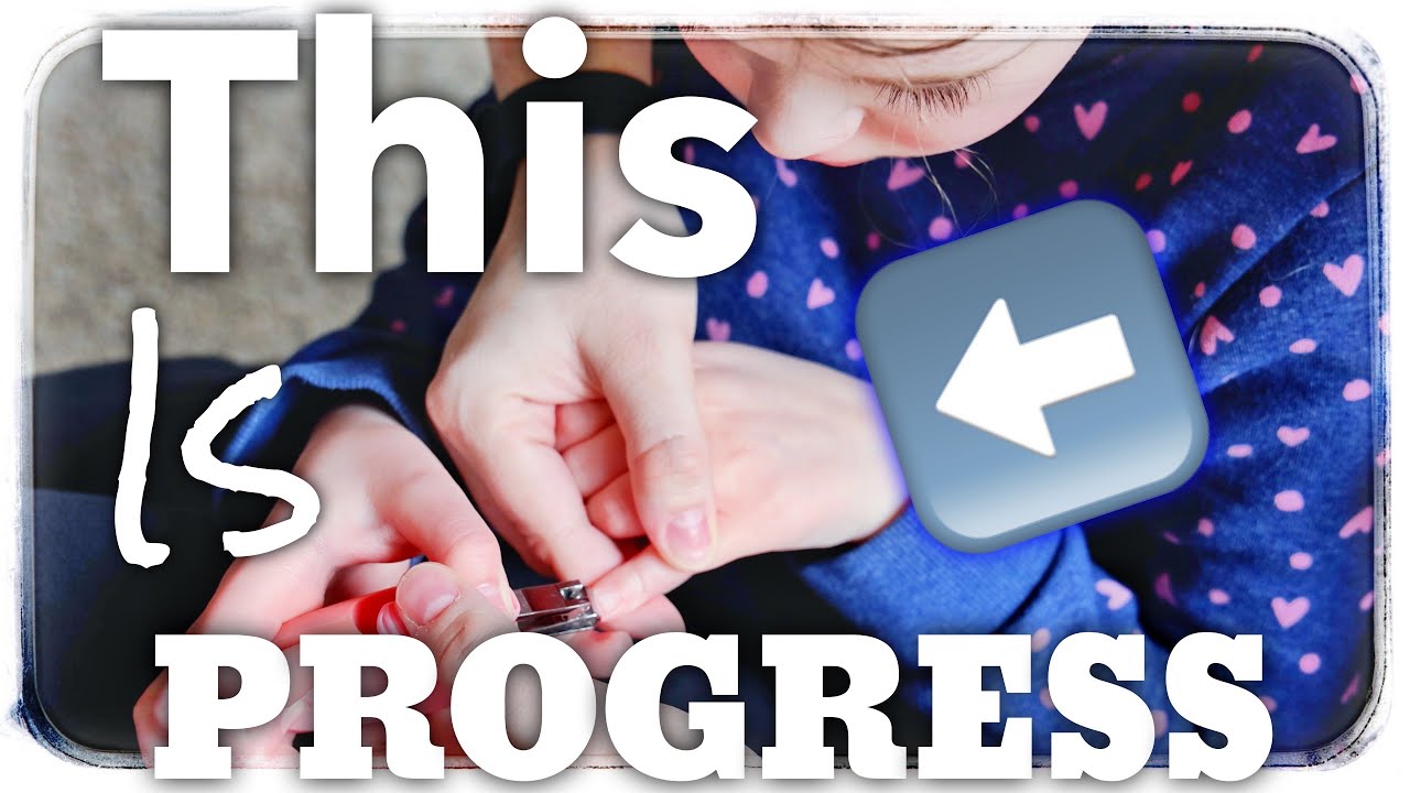 How Do We Clip Our Autistic Daughter’s Fingernails?
