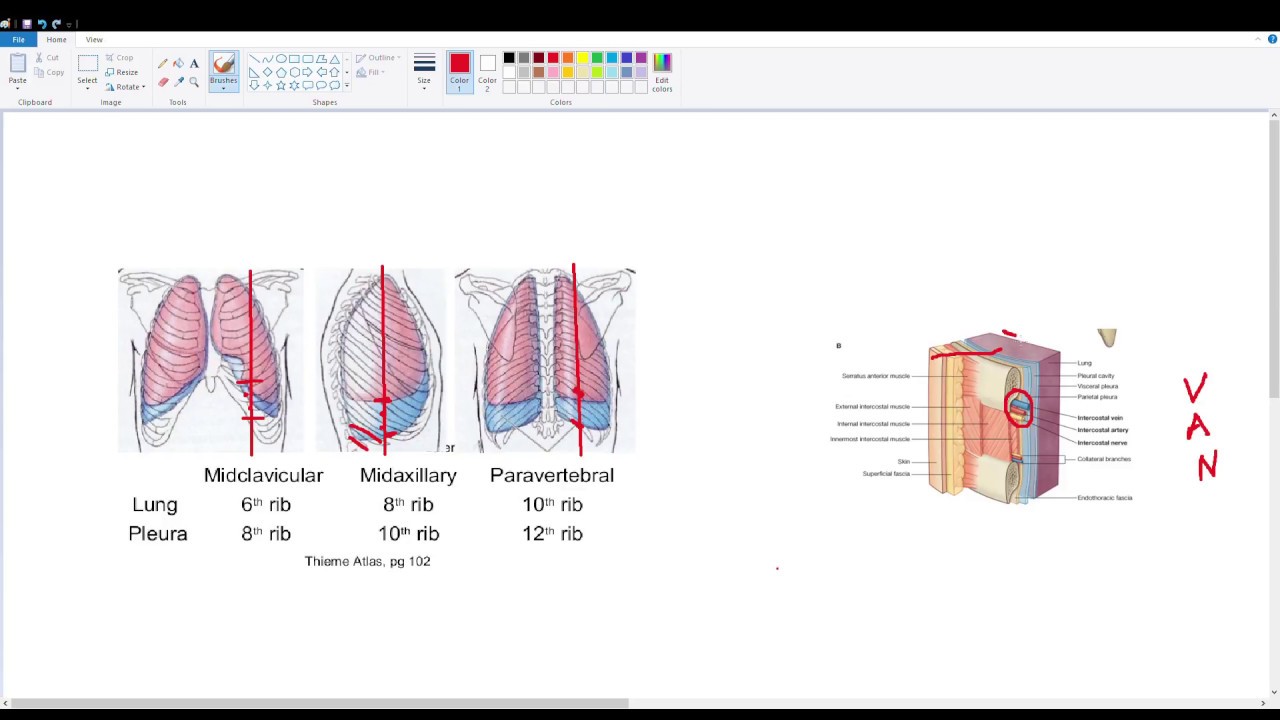 Thoracentesis Quick Review