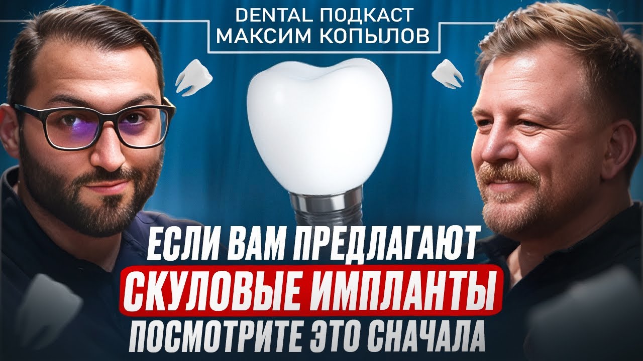 Скуловые импланты: чего бояться и что важно знать &mdash; большой выпуск |Максим Копылов  | Dental Podcast