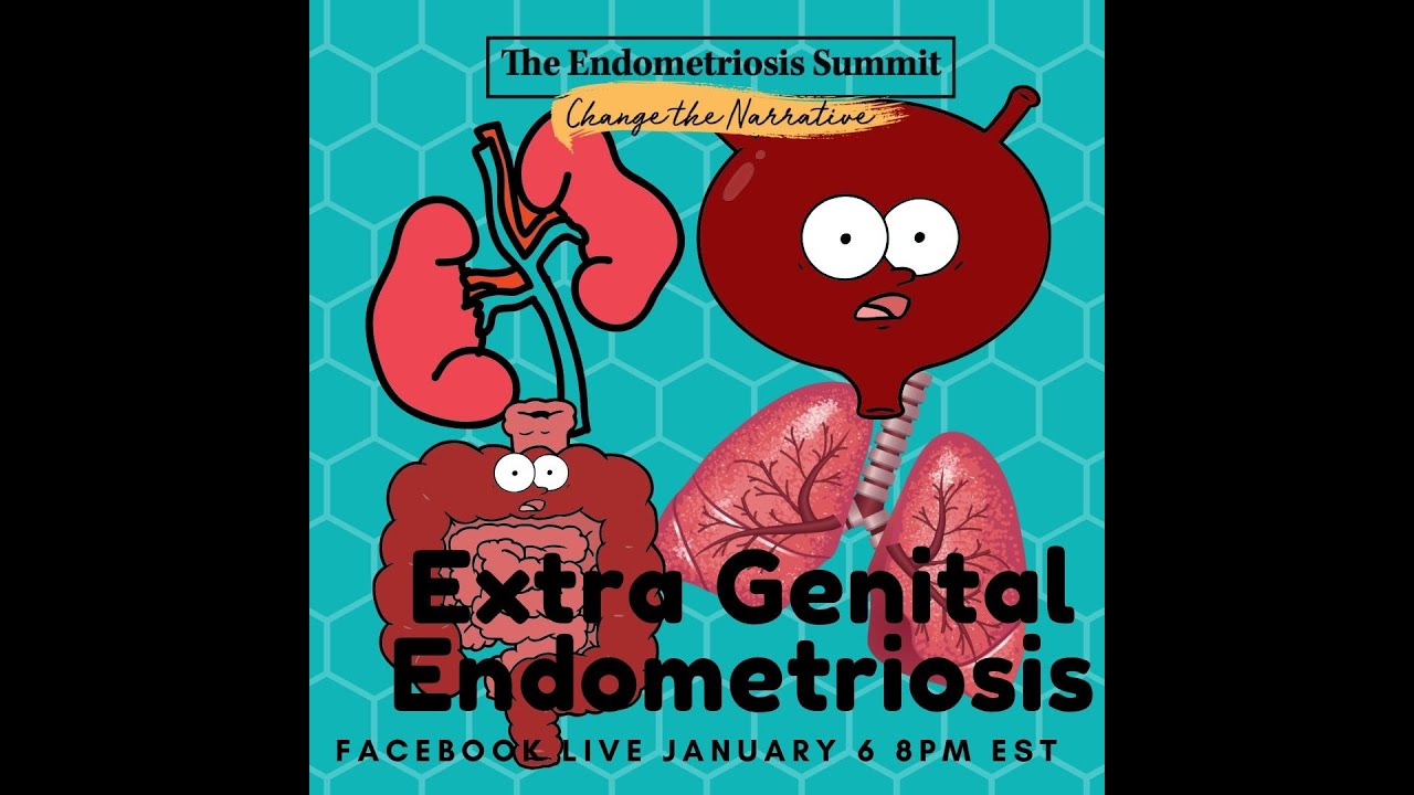 Endometriosis Beyond the Pelvis