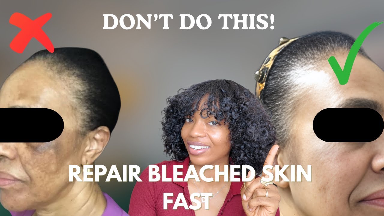From damaged to GLOWING: How to restore your natural skin barrier after BLEACHING