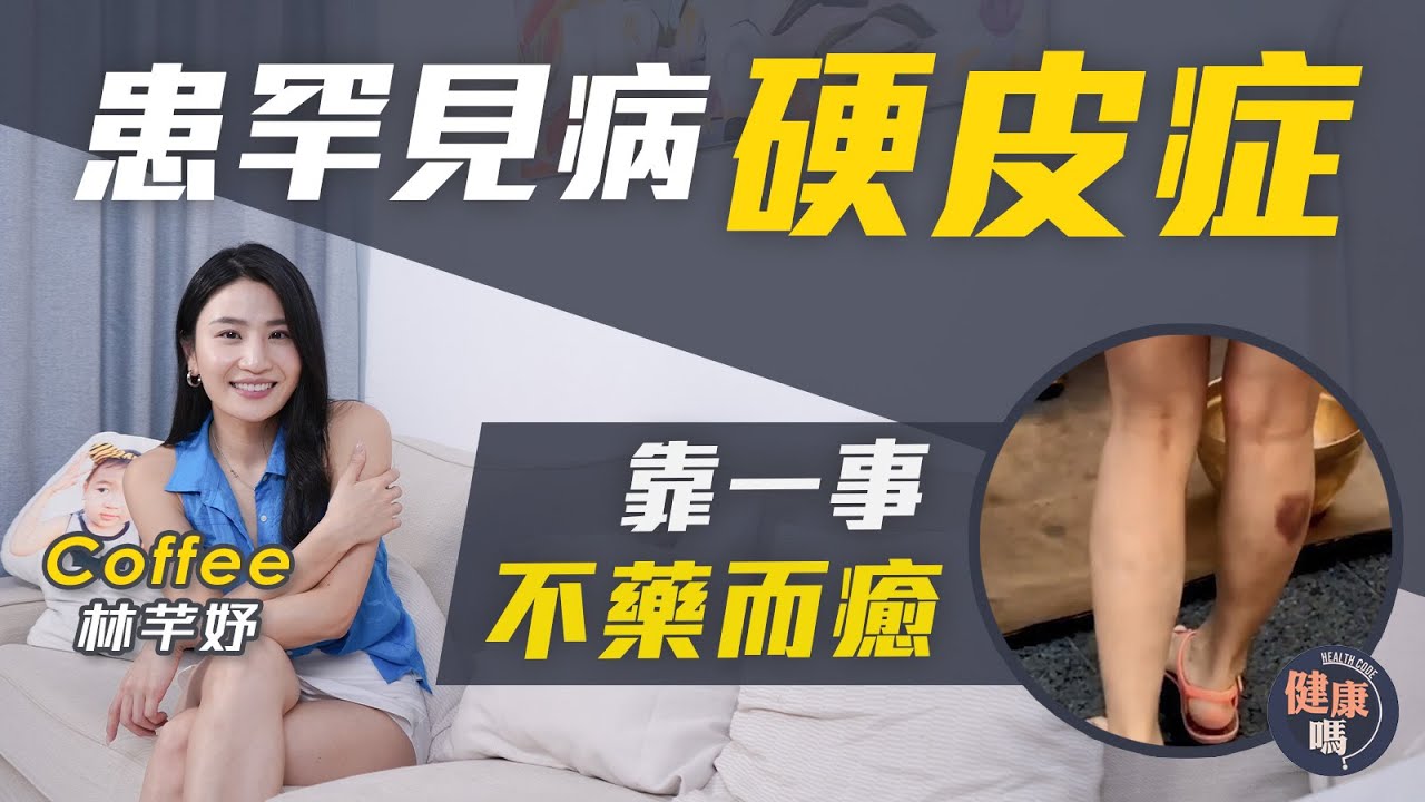 Coffee 林芊妤專訪（上）｜患硬皮症肌肉萎縮無藥可醫 放棄治療躺平竟痊愈？｜術後直踩21小時拍攝 傷口大出血入院｜走過鬼門關 悟健康真諦｜健康嗎‪@HealthCodeHK【醫檔案】