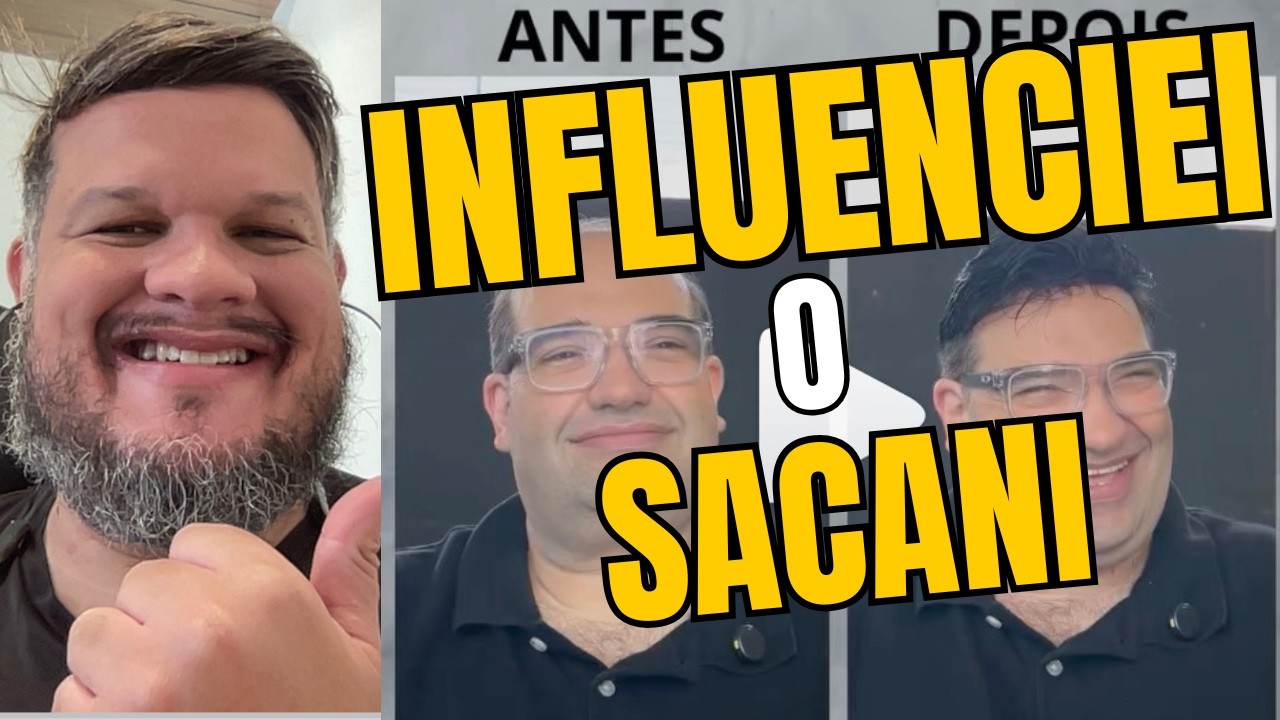 INSPIREI O SERGIO SACANI A COLOCAR PRÓTESE CAPILAR