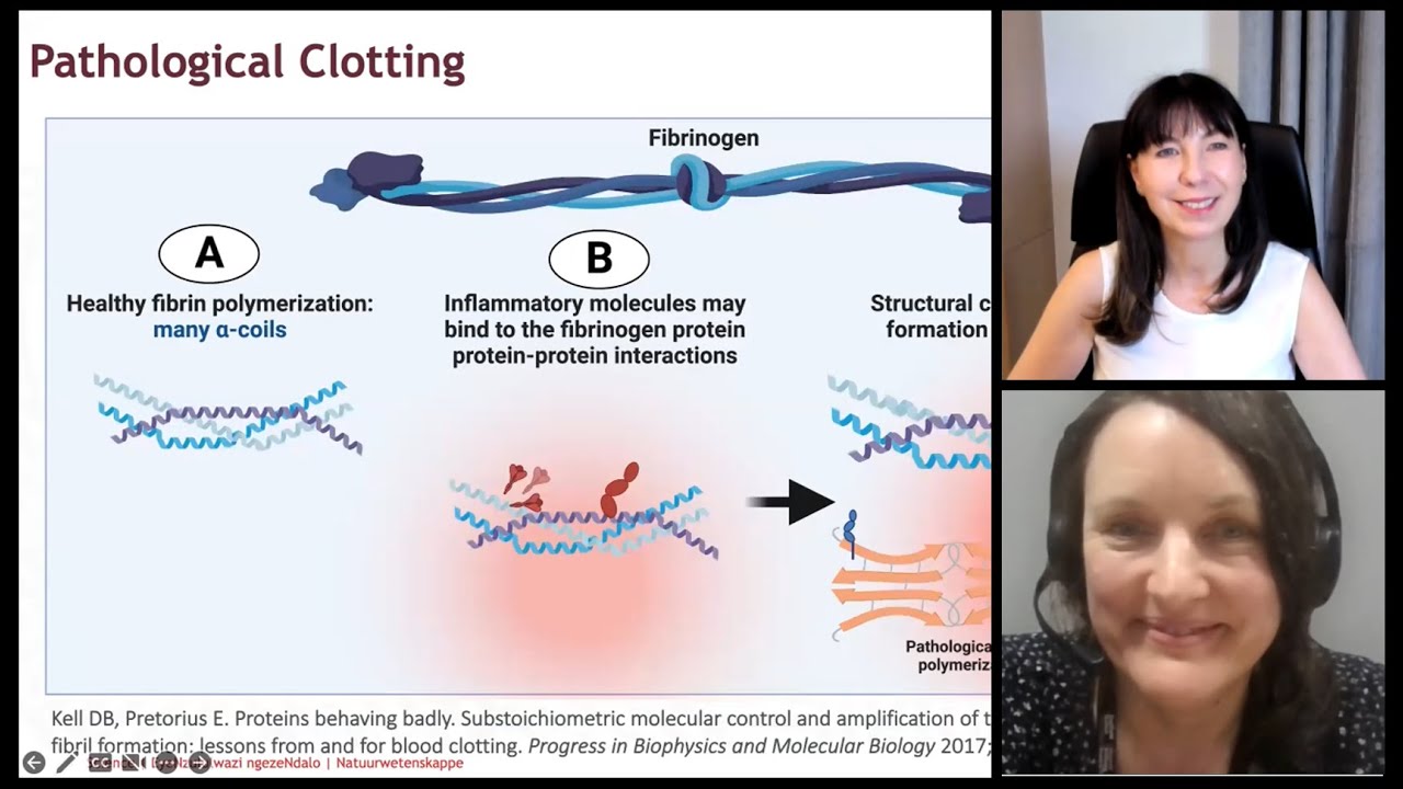 Vascular pathology in post-viral conditions: the role of Microclots