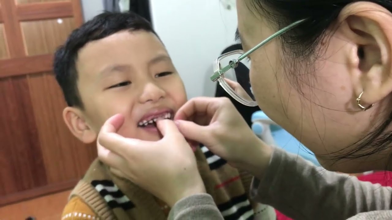 Rô rụng cái răng thứ 4 