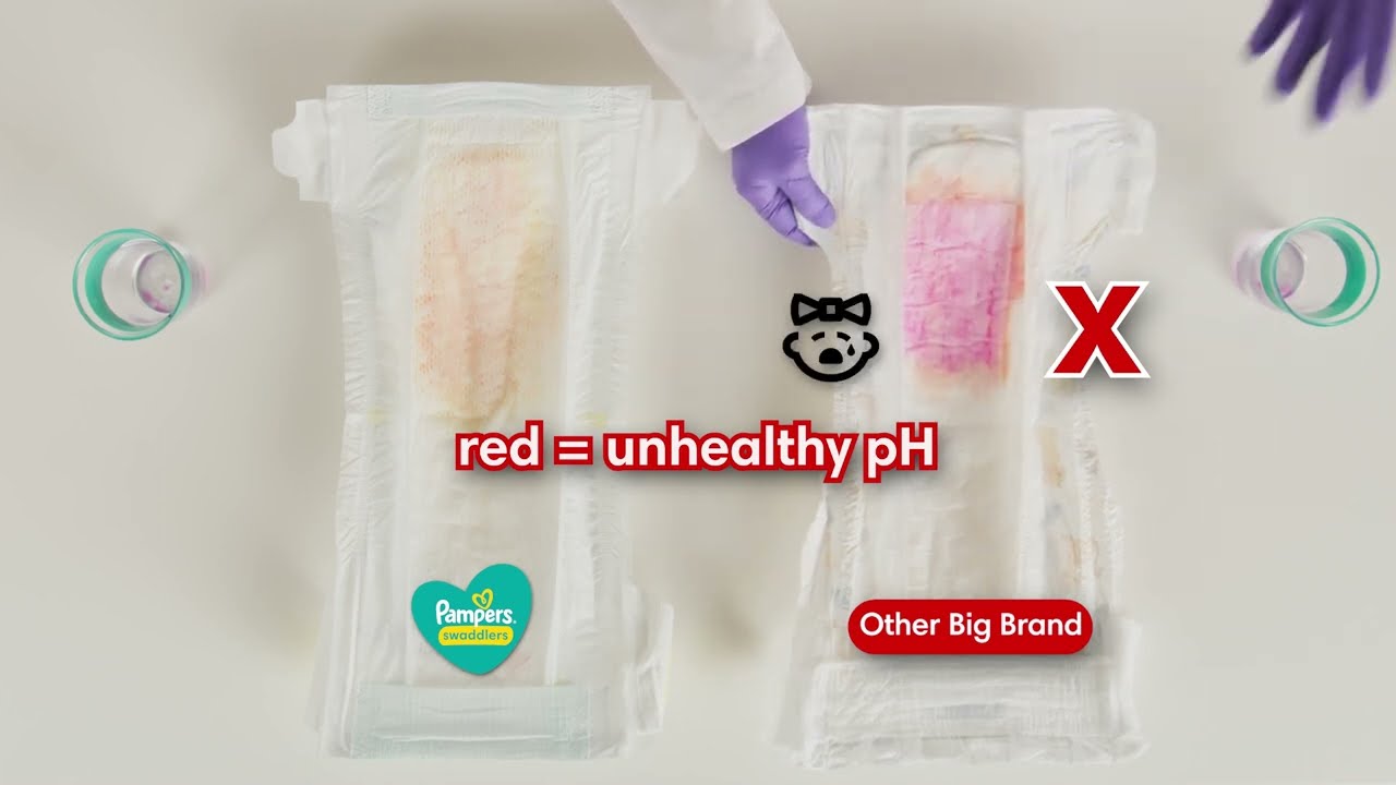 Pampers | Causes of Diaper Rash - Skin pH