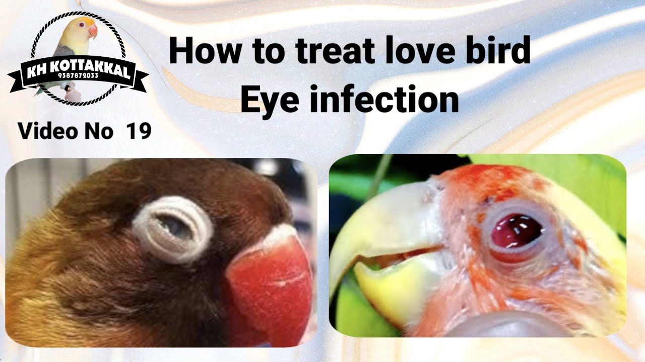 Eye infection എങ്ങനെ മാറ്റി എടുക്കാം