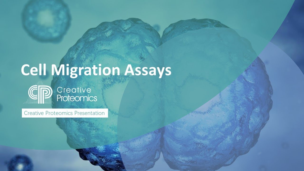 Cell Migration Assay
