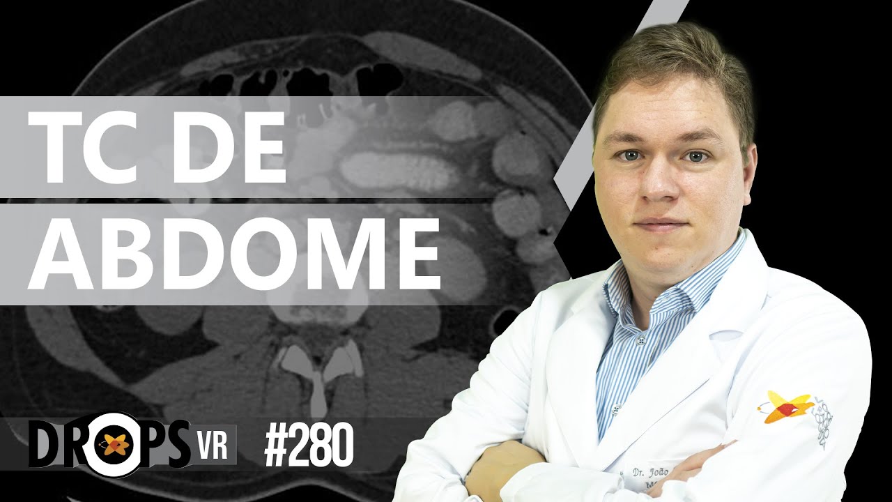 COMO NÃO DEIXAR NADA PASSAR NA TC DE ABDOME!