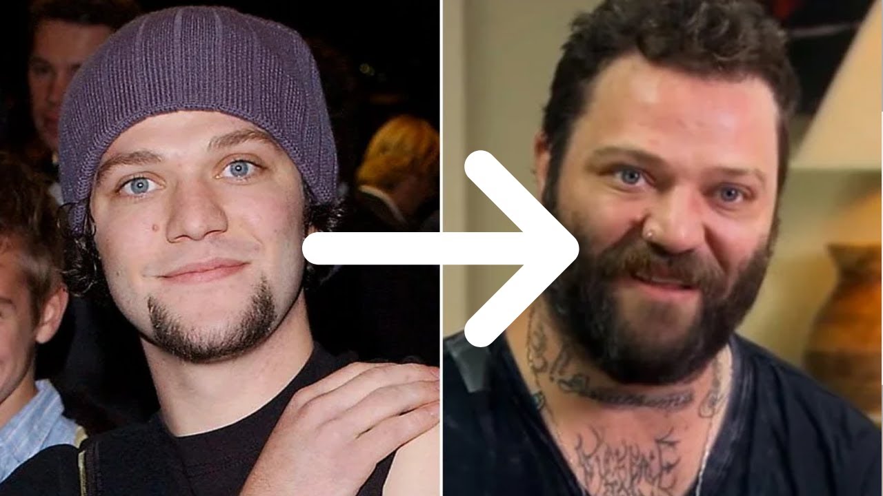 The Decline of Bam Margera...What Happened? (Jackass Star)