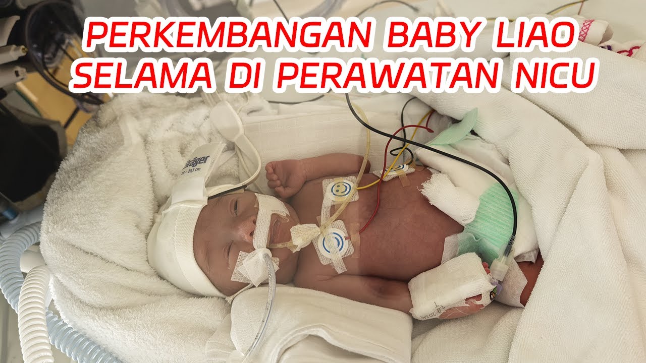 PERJUANGAN BAYI PREMATUR , LAHIR DENGAN BERAT BADAN 900 GRAM , DUNIA MENYAMBUTMU PEJUANG KECILKU